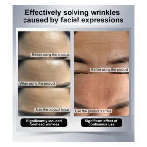 MSF Secret Strips Anti-Wrinkle Forehead Strips