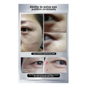 MSF Secret Strips Anti-Wrinkles Eye Strips
